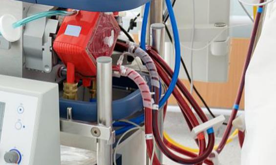 盆馬達電機反轉(zhuǎn)，盆馬達電機反轉(zhuǎn)原因及解決方法